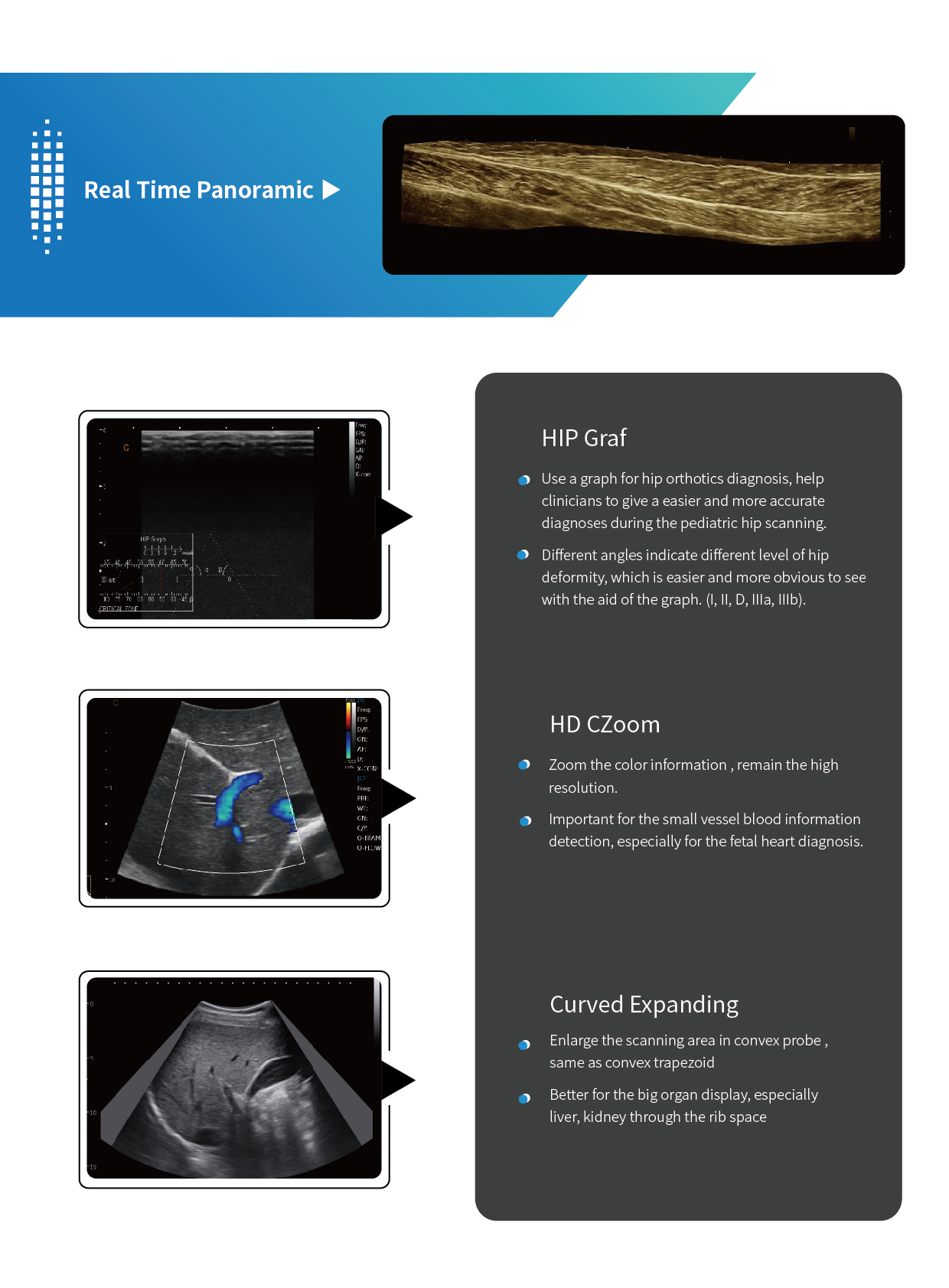 Ultrasound CHISON CBIT6 - Image 7