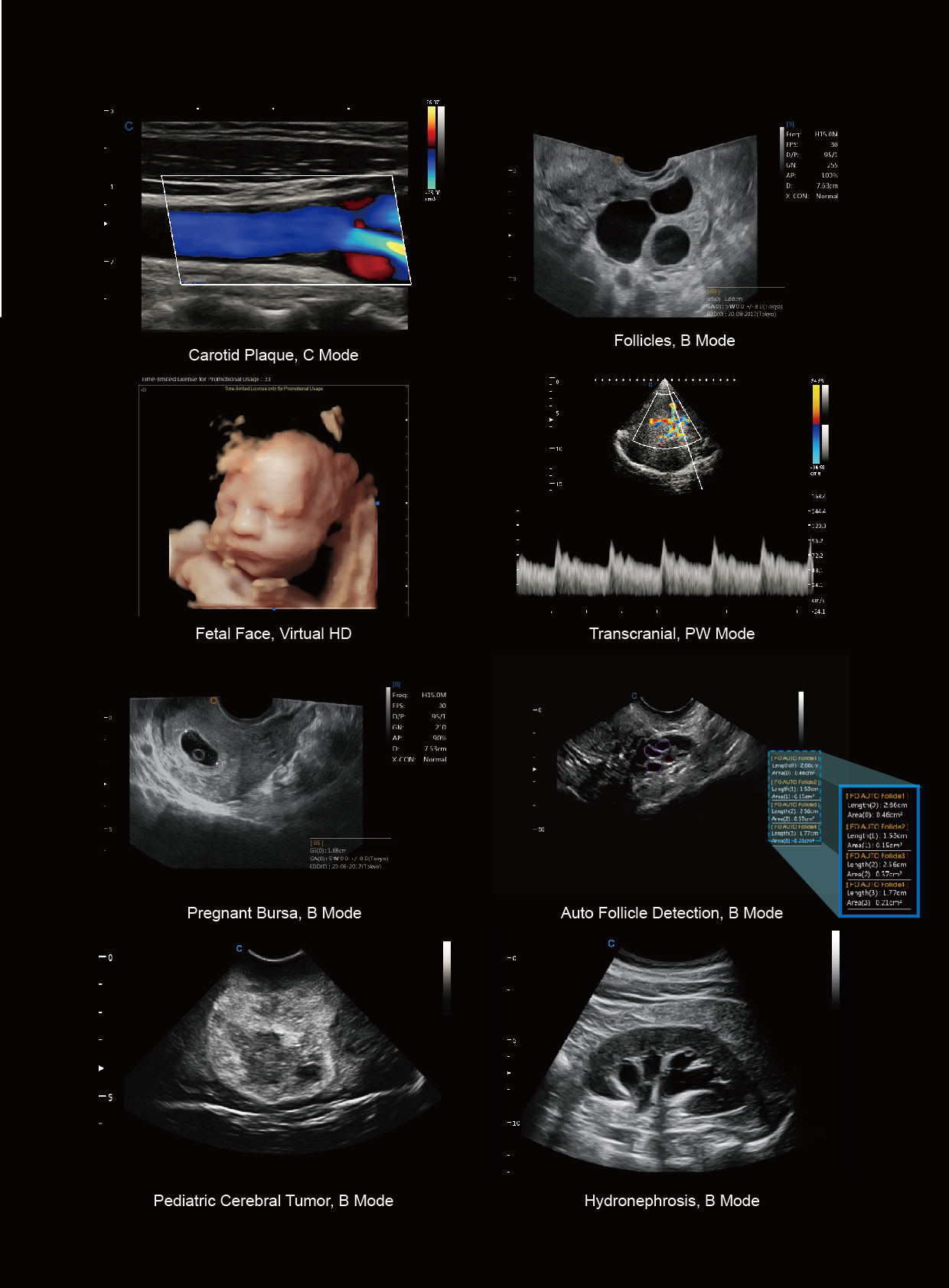 Ultrasound CHISON CBIT6 - Image 8